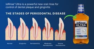 Is Brushing & Flossing Alone The Best Way To Prevent Periodontal Disease? Maybe Not.