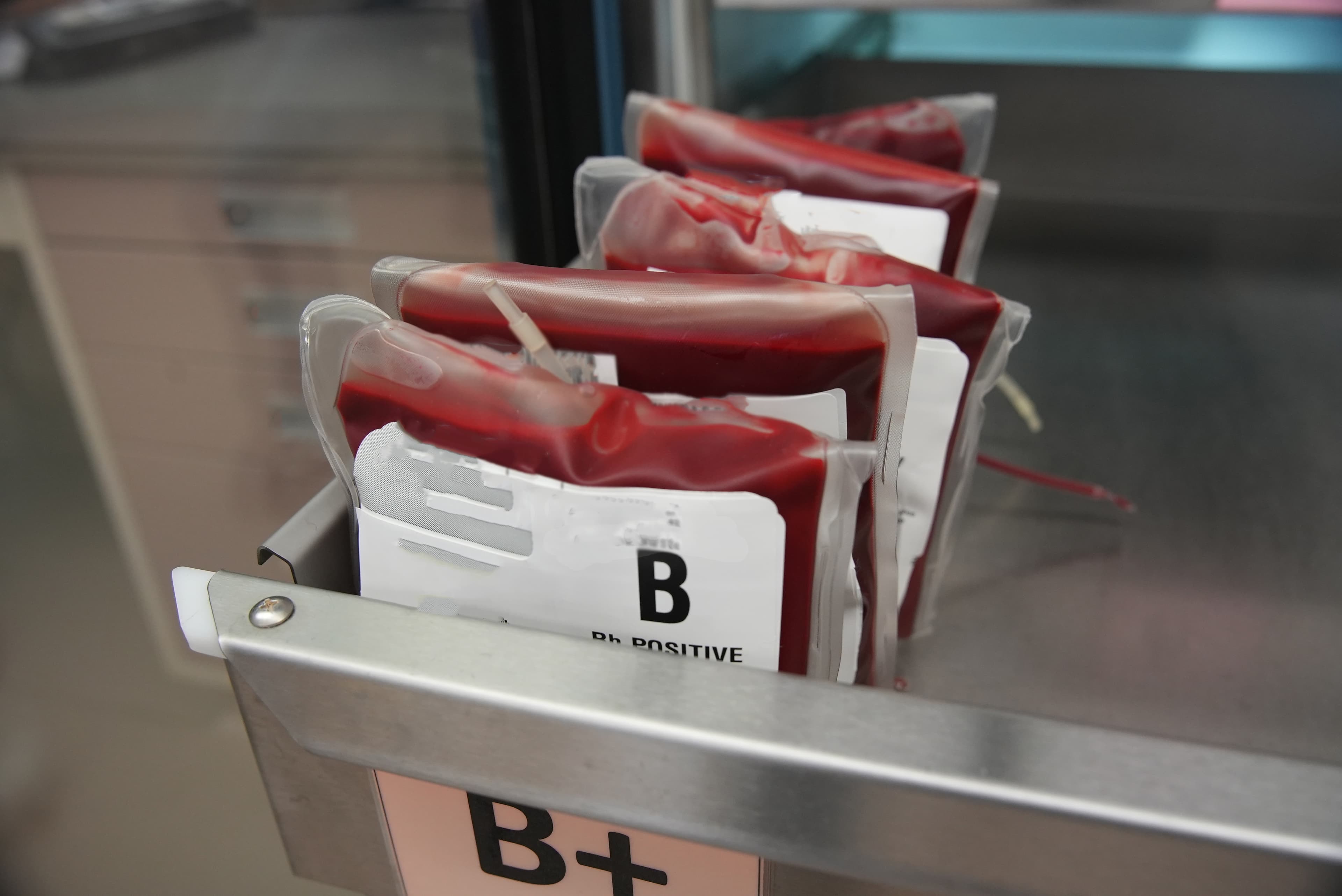 Earlier Blood Transfusion Timing May Reduce Heart Failure and Arrhythmia Risk in Cardiac Patients After Surgery