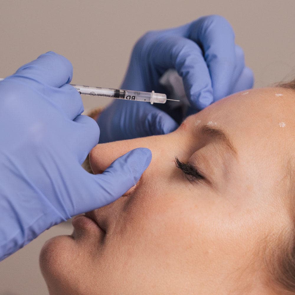 Laser Center of Marin Offers Comprehensive Botox Treatments for Natural Rejuvenation