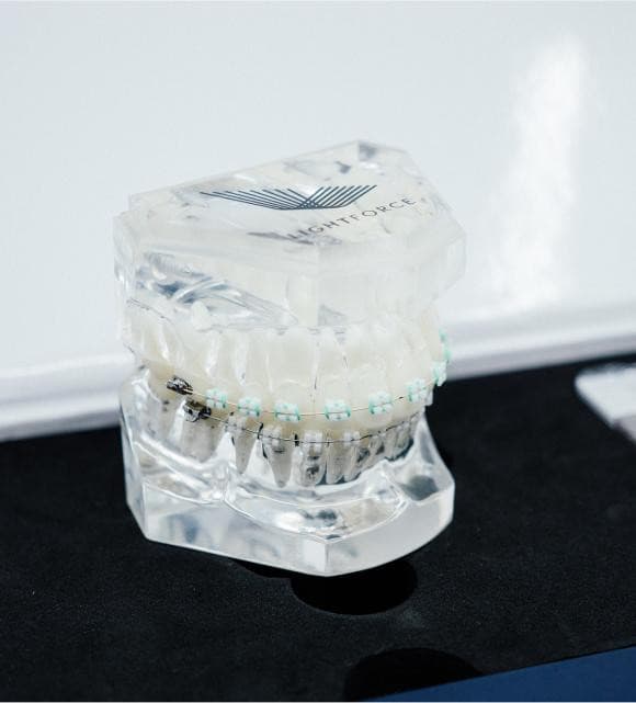 TG Orthodontics Introduces Lightforce Braces for Customized Smile Transformations