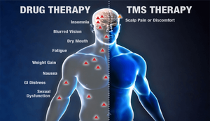 banner image for: TMS Treatment for OCD Offers Effective Relief for Patients Resistant to First-Line Treatments